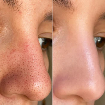 Radiant Peel Pro - Piel radiante desde el primer uso