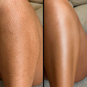 Radiant Peel Pro - Piel radiante desde el primer uso